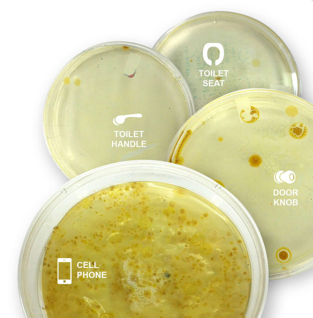 Bacteria in petri dish showing mobile contamination